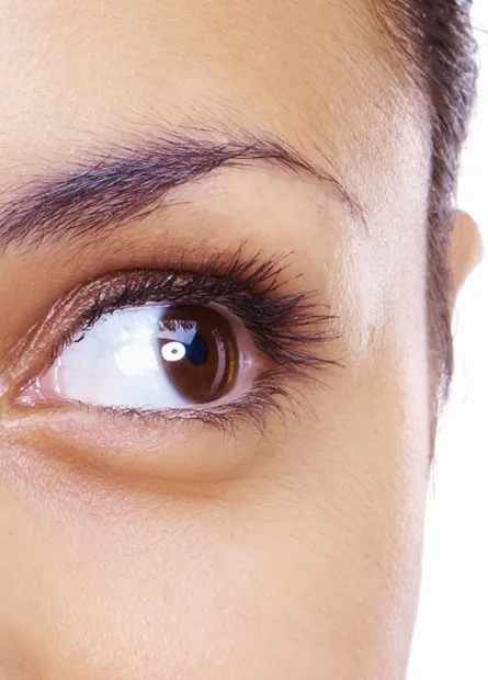 Eyelid Surgery